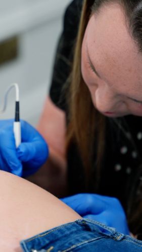 Electrolysis probe close up during professional training session